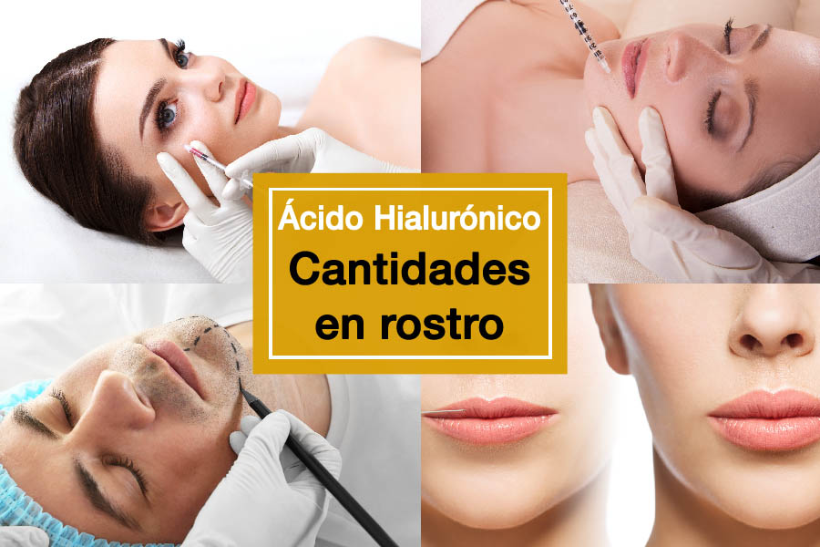 Ácido hialurónico Cantidades en rostro