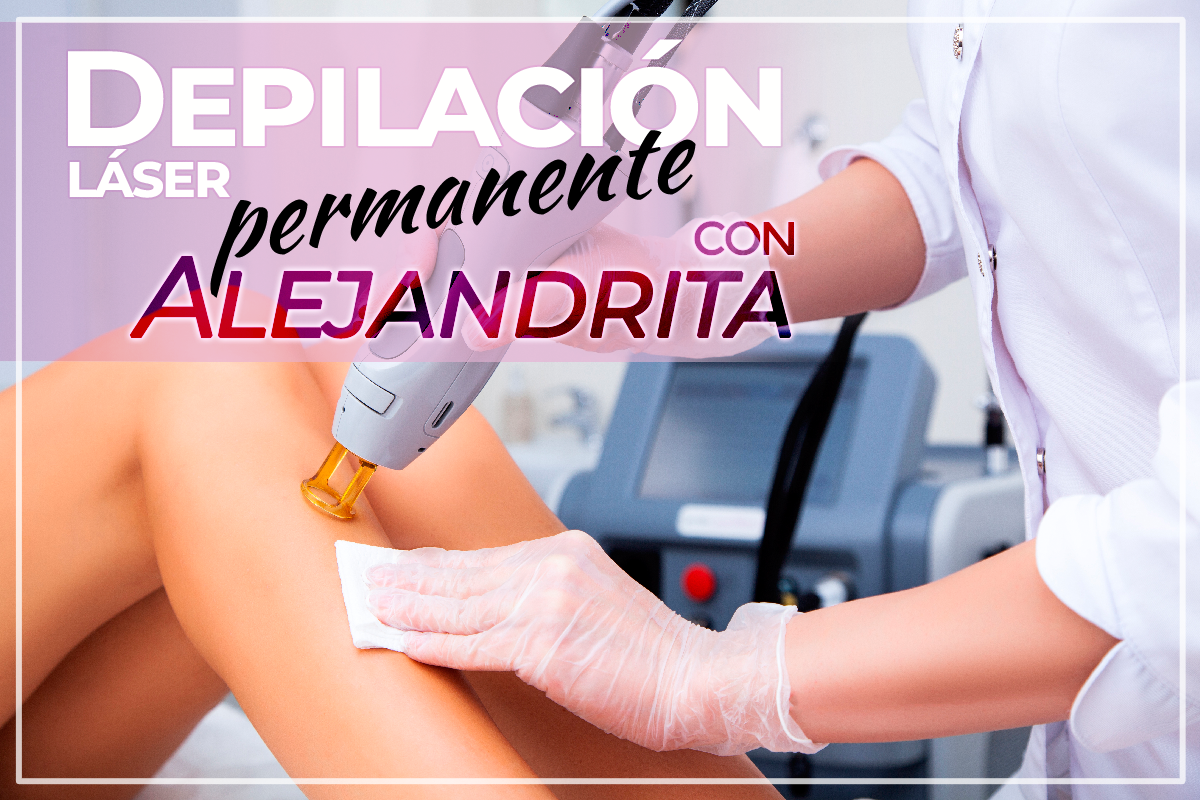 Depilación láser